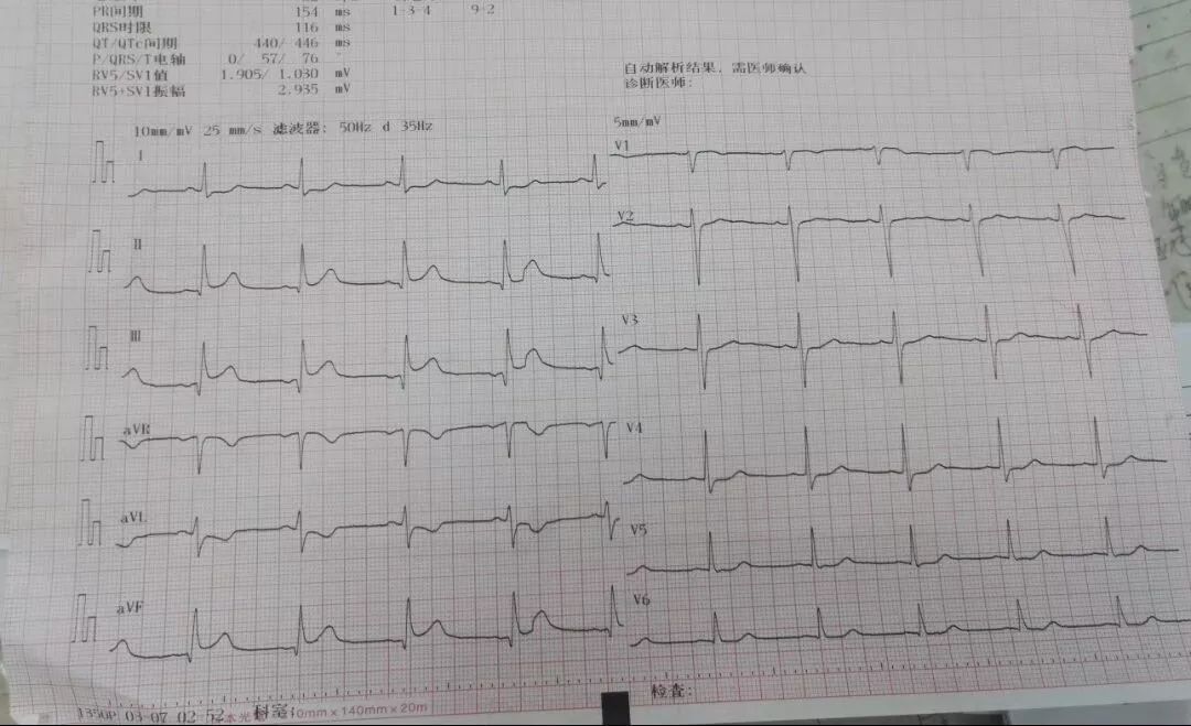 81594ff7d86e9beb2c6d29d239e956f1.jpg