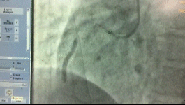 cdd6ef593b06de0463e3067048e165bc.gif